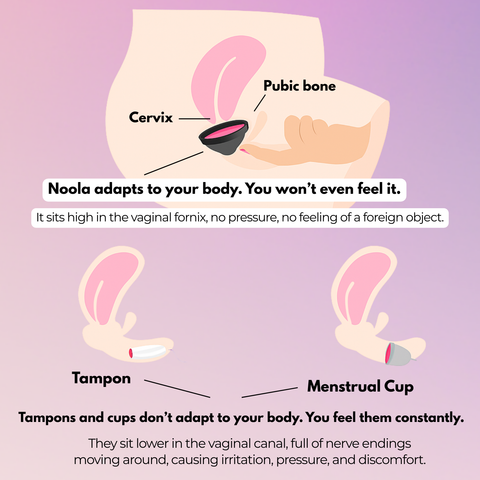 Noola Menstrual Disc