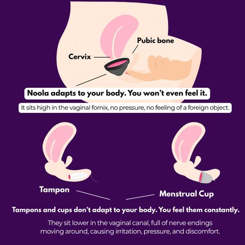 Noola Menstrual Disc From BPA-Free Medica Grade Silicone